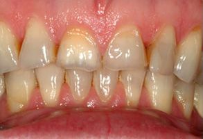 Dental Artistry of Livingston | Veneers, Dental Bridges and Oral Exams